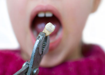 Kieferorthopädie ohne Zähne ziehen