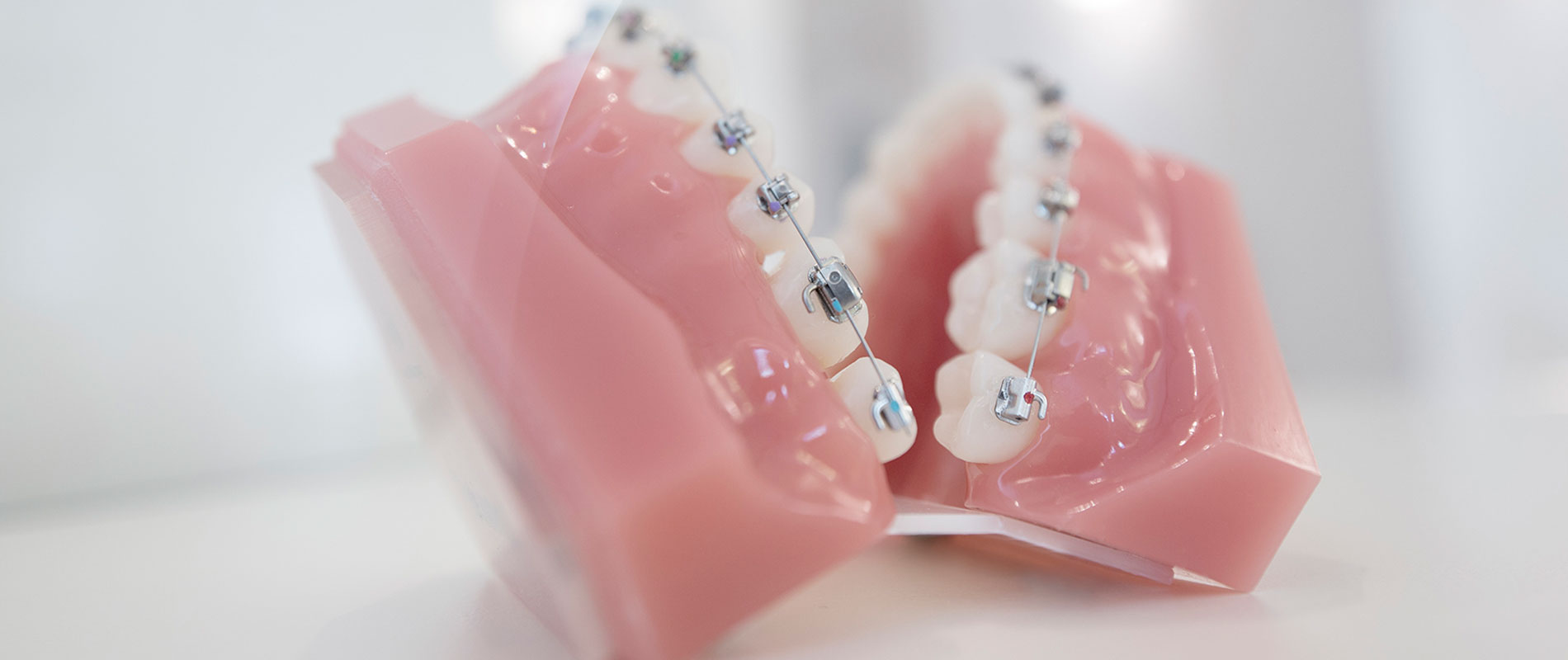 Kieferorthopädie ohne Zähne ziehen, Dr. Lederer München